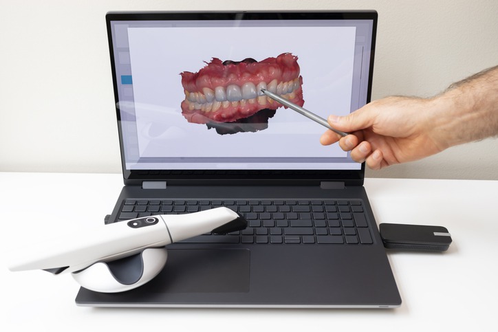 What Are the Benefits of Digital Dentistry